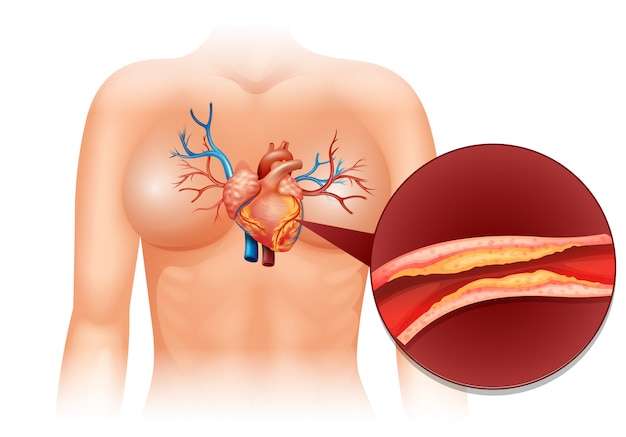 Hình vẽ vector Cholesterol tim ở người