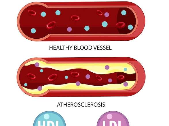 Hình vector Các loại cholesterol hdl và ldl